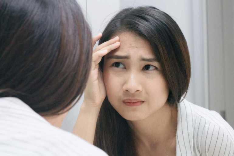 acne-zits-solution